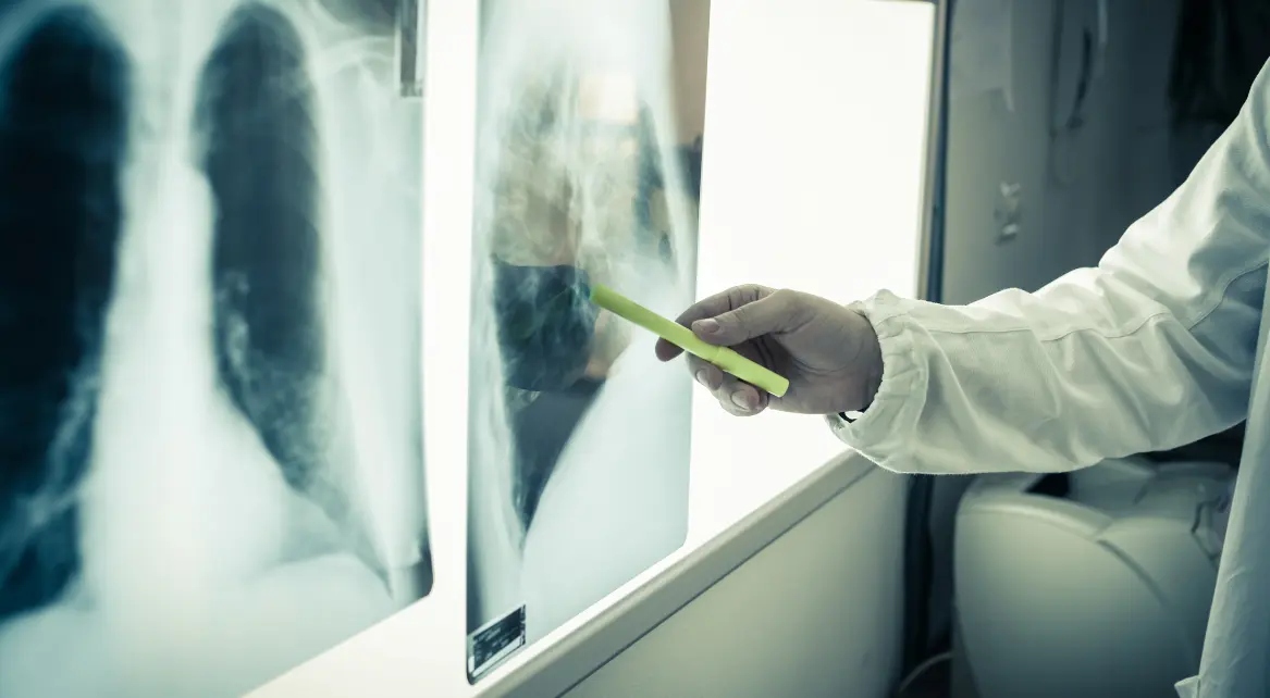 Raio X Centro Radiologico de Caratinga